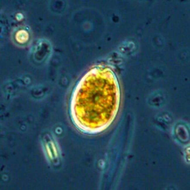 A microscopic photo of a toxic microalgae.