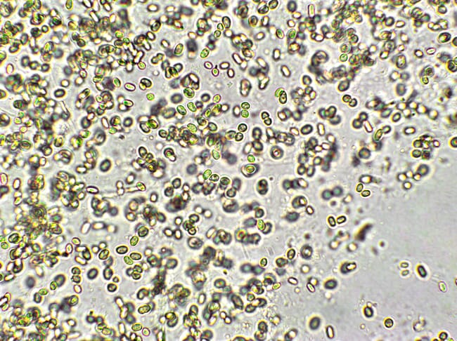 microalgae under the microscope