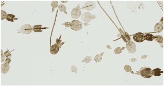 Many sealice under a microscope.