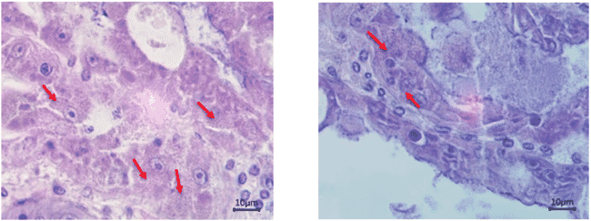 Imagem de tecido infectado com EHP em um microscópio.