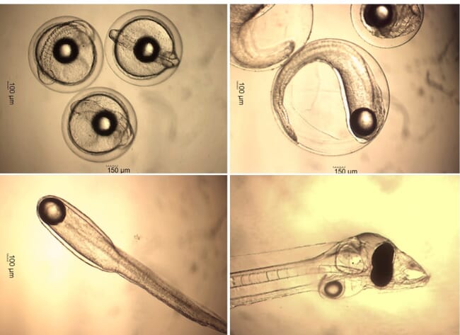 Glass eel eggs and early larvae.