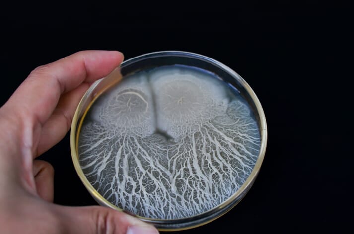 person holding a Petri dish on a black background