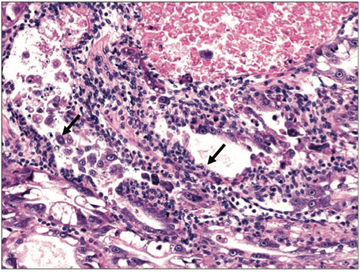 Slide showing the epithelial cells of the hepatopancreas in juvenile shrimp