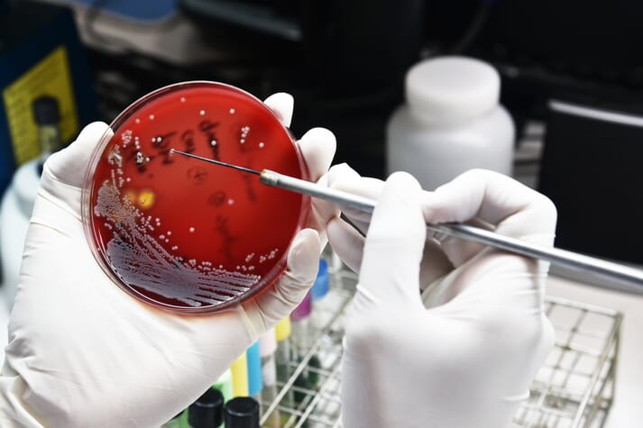 Petri dish showing bacterial colonies growing