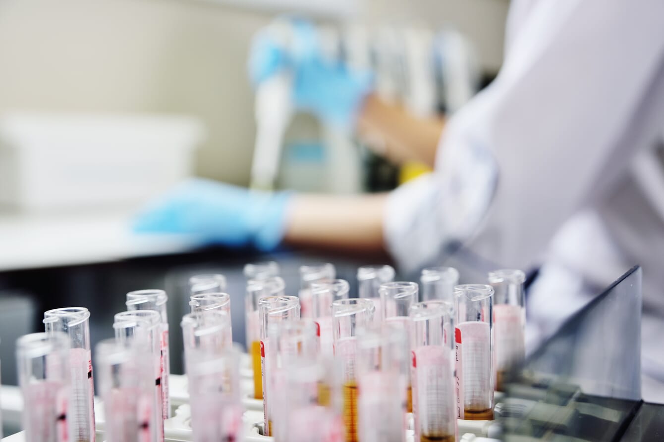 A scientist manipulating PCR test tubes in a laboratory.