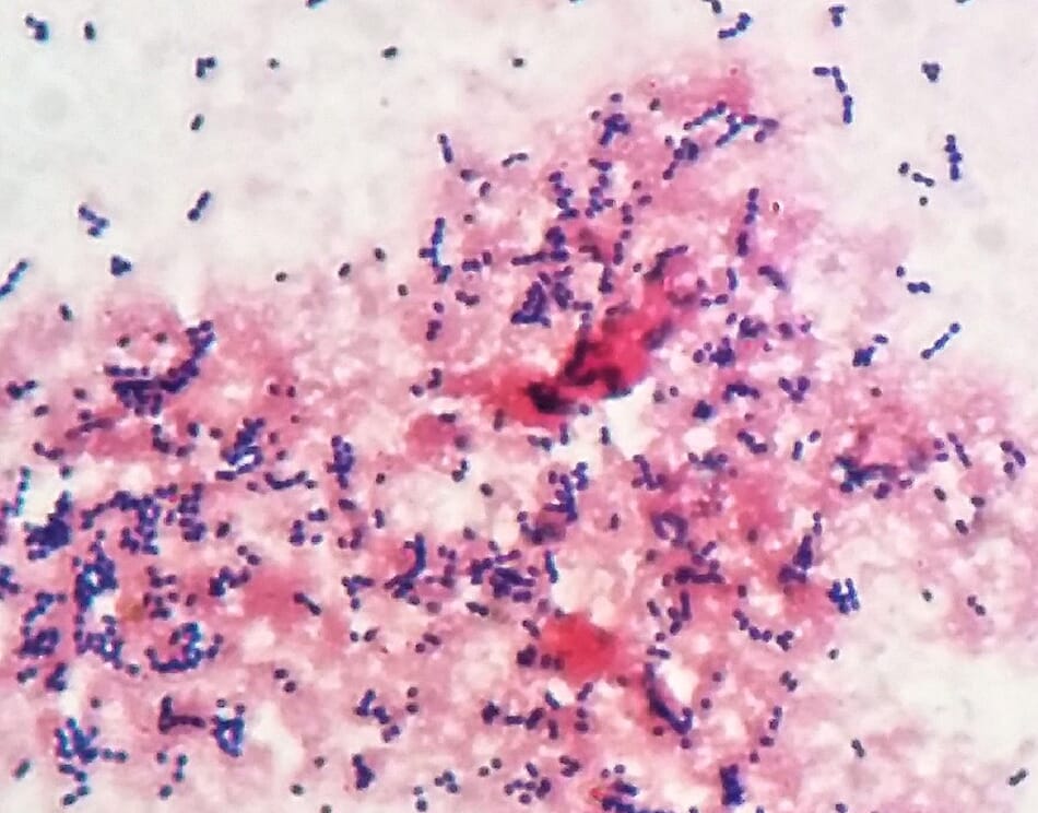 How to recognise and counter Streptococcus outbreaks in aquaculture ...