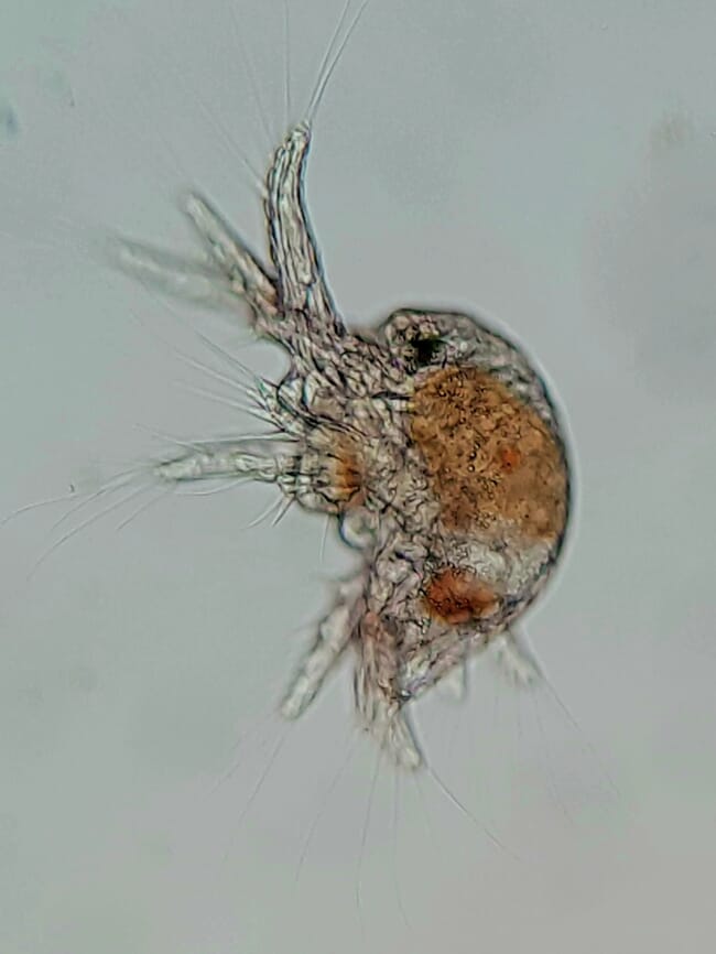 Zooplankton under the microscope.