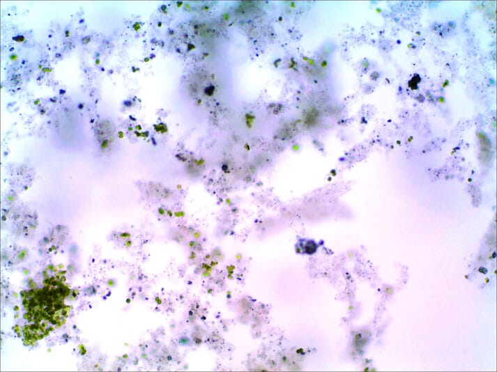 Algal cells attached to a biofloc
