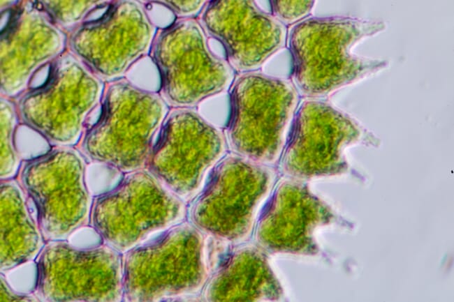 Algae seen under a microscope.