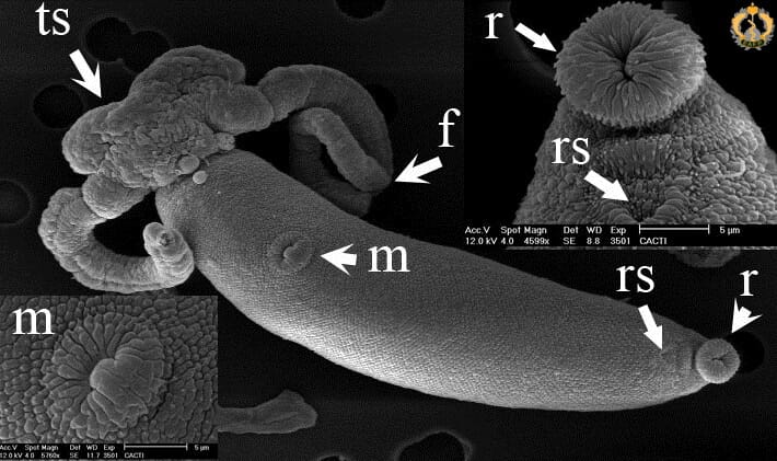 The winning SEM image of a trematode from razor clams