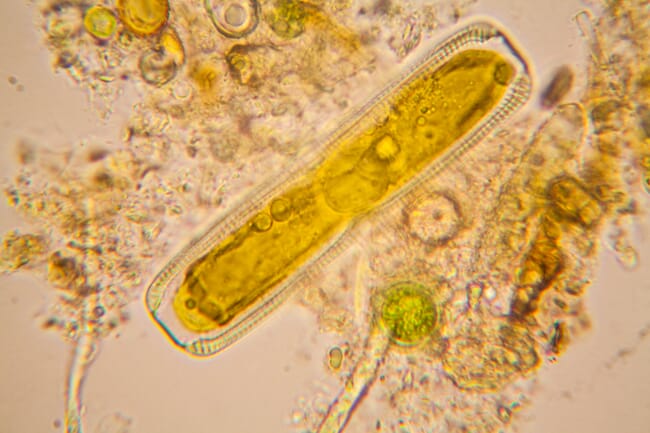 Plâncton sob um microscópio