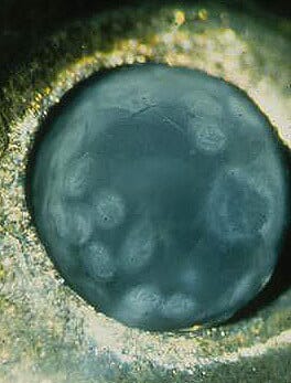 Diplostomum spathaceum - Courtesy Zoologisches Institut I der Universität Karlsruhe (TH)